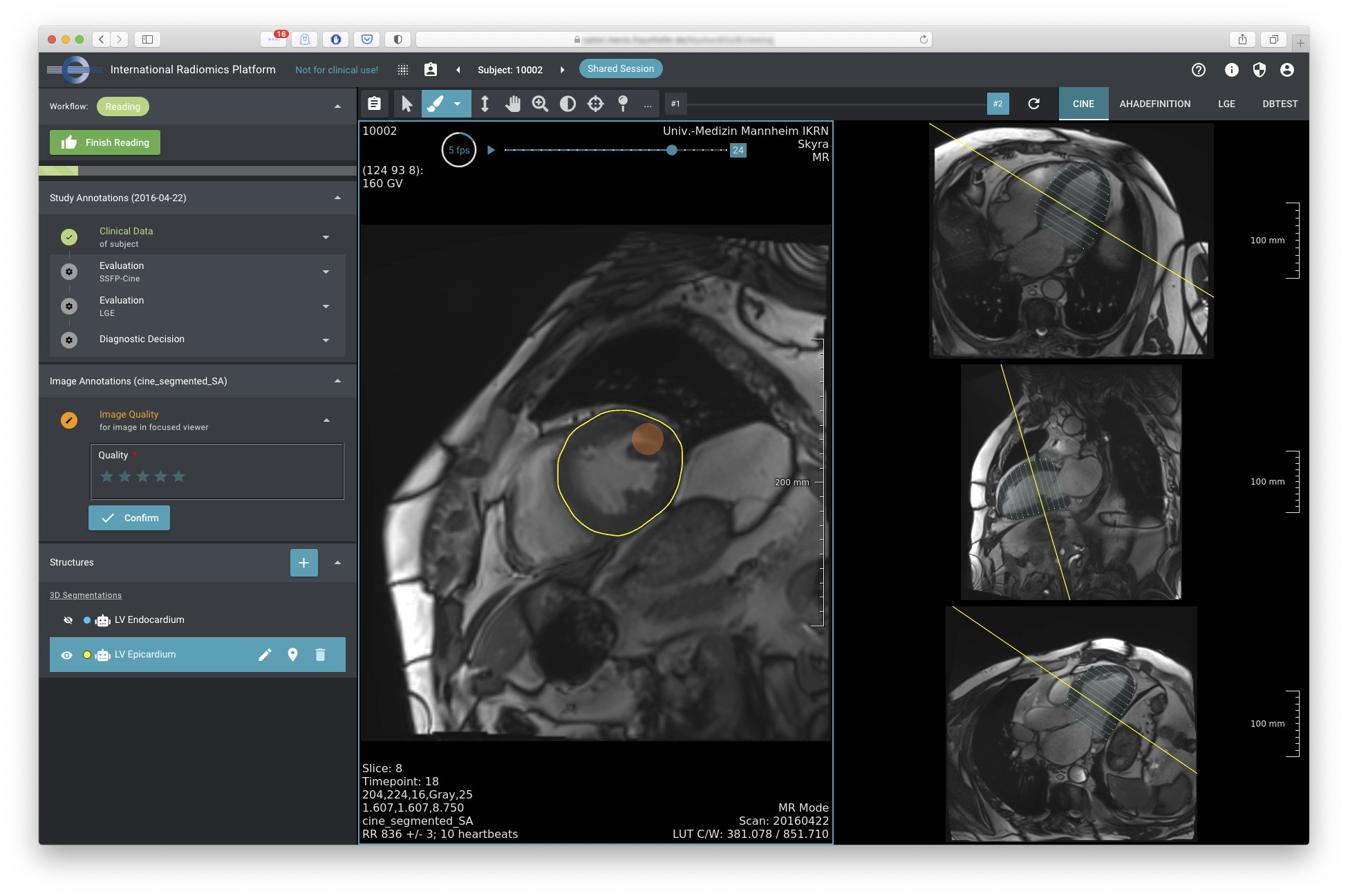 SATORI zeigt radiologische Bilder neben relevanter klinischer Informationen und gefundener Strukturen anzeigt