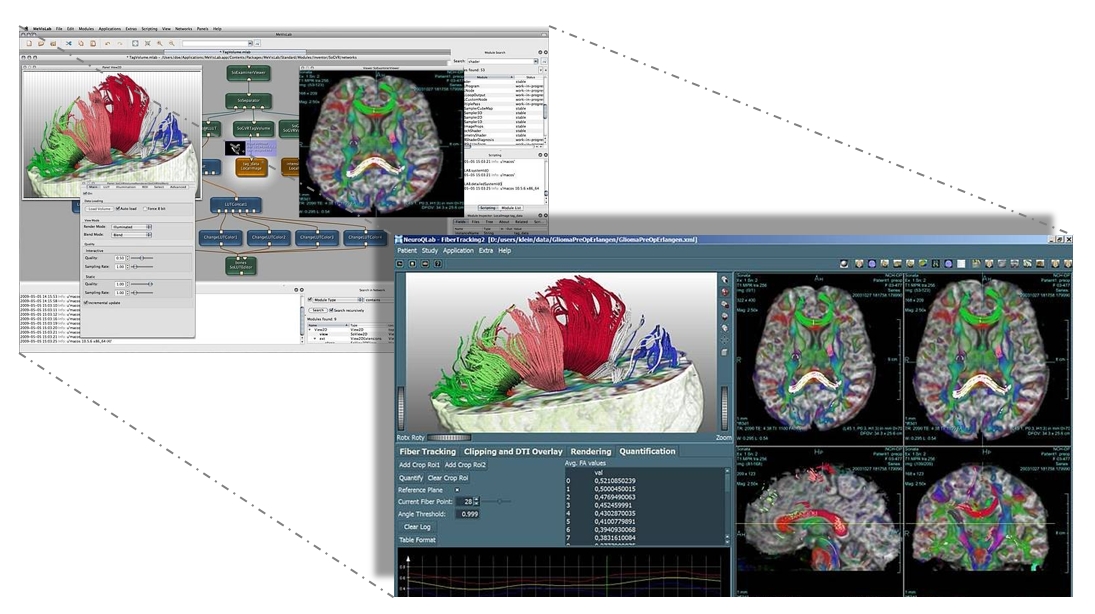 MeVisLab Software User Interface